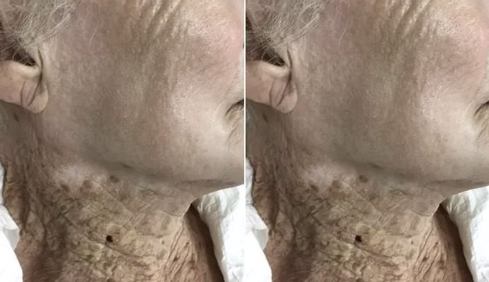 Journal of the European Academy of Dermatology and Venereology