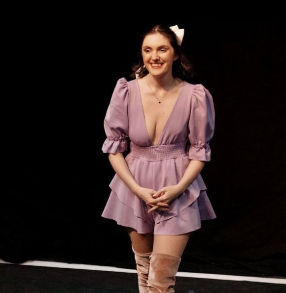 ‘폴란드 증후군’을 앓고 있는 레베카 부처. 레베카 부처 SNS