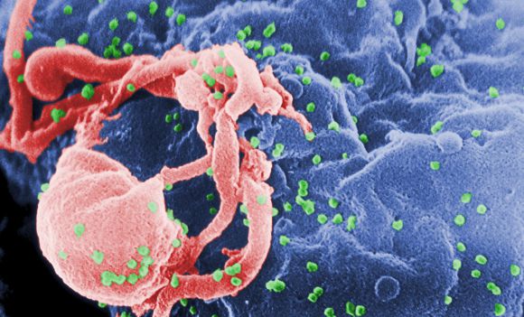 인간면역결핍바이러스(HIV) 관련 이미지. 위키피디아