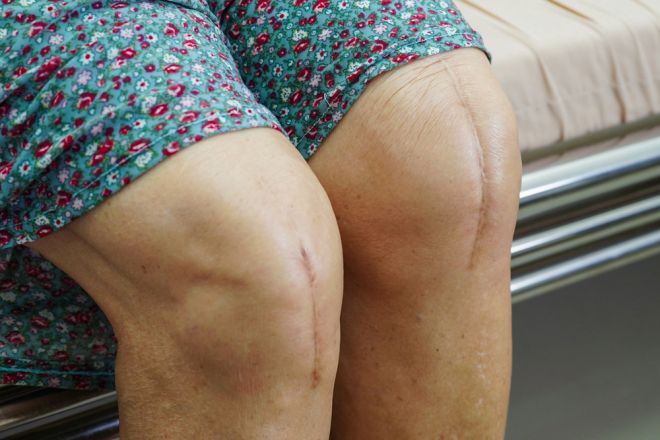 일본 나라의과대 연구팀이 93만여 명을 분석한 결과, 주 3회 이상 아침을 거르거나 취침 2시간 전 저녁식사를 하면 골다공증 위험이 증가하는 것으로 나타났다. 아이클릭아트