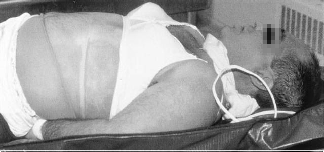 여성 속옷을 입은 채 질식사한 외국 남자. 끈 때문에 자기 목에 가해질 통증을 피하려고 목 주위에 천을 감았지만 죽음의 그림자는 막지 못했다.