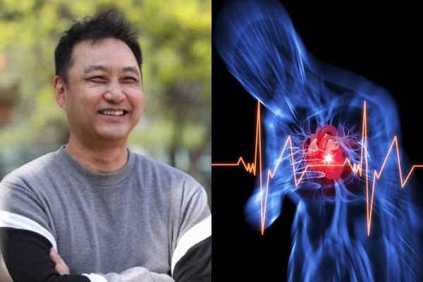 개그맨 김수용과 심근경색. 연합뉴스, 하버드대의대.