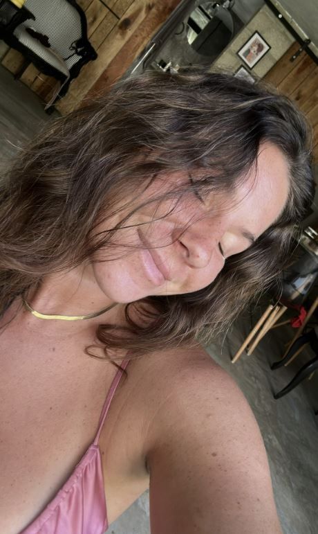 노소비츠키가 시력을 잃기 전 모습. 페이스북 캡처