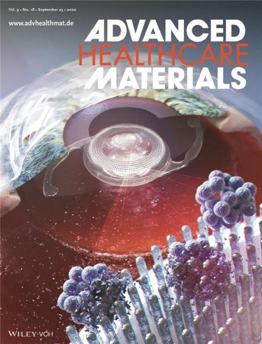 백내장 수술 때 발생하는 병원성 박테리아 감염을 줄이기 위해 반도체 공정기술을 활용해 개발된 '항균성 인공수정체' 관련 연구성과가 실린 국제 학술지 표지. 나노종합기술원 제공