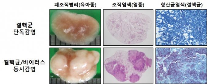 결핵균-바이러스 동시감염 후 중증 결핵으로 악화된 폐 병리, 단독감염군과 비교해 바이러스 동시감염군에서 괴사성 육아종이 동반된 중증 폐 병리와 광범위한 폐 염증이 관찰됐다./사진제공=연세대 세브란스병원