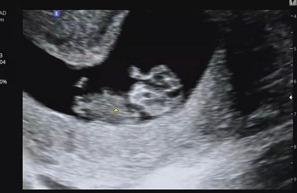 /사진=최희 인스타그램 캡처