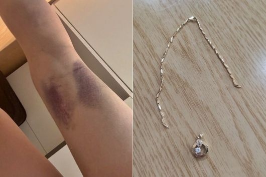 지난 1월 피해자 B씨 유족이 공개한 사진. 유족은 숨진 B씨가 전 남자친구 A씨로부터 상습적인 폭언과 폭행을 당했다고 주장했다./사진=온라인 커뮤니티