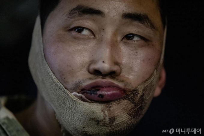 볼로디미르 젤렌스키 우크라이나 대통령이 지난달 11일 생포된 북한군 2명의 모습을 담은 사진을 공개했다. 사진은 얼굴에 부상당한 북한군 리모씨. / 사진=뉴시스