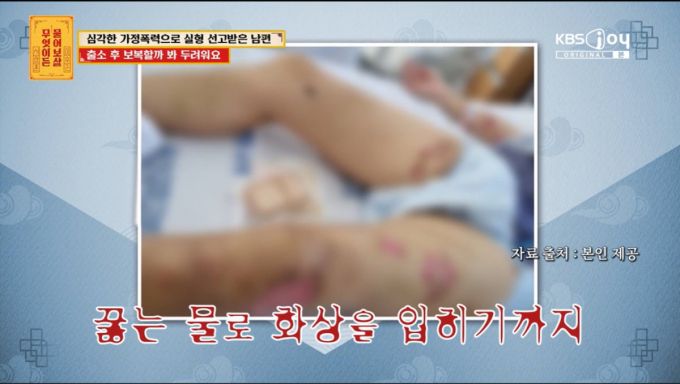 사연자가 남편에게 심한 가정 폭력을 당했다고 전했다. /사진=KBS JOY '무엇이든 물어보살' 캡처