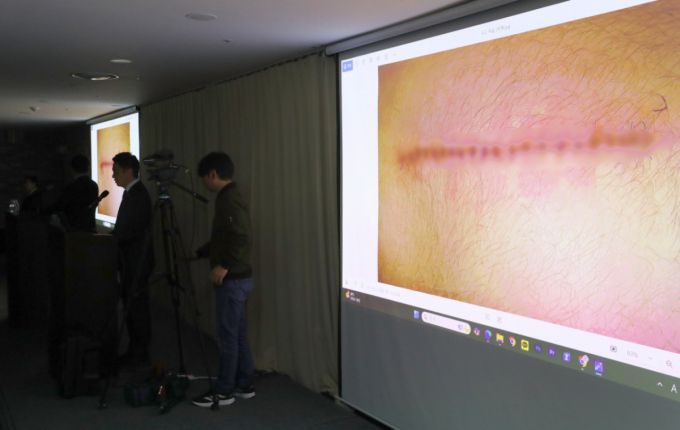 김세의 가로세로연구소 대표가 7일 오후 서울 강남구 스페이스쉐어에서 열린 배우 김수현의 중대범죄 관련 기자회견에서 제보자가 피습당한 사진을 공개하고 있다. /사진=뉴시스