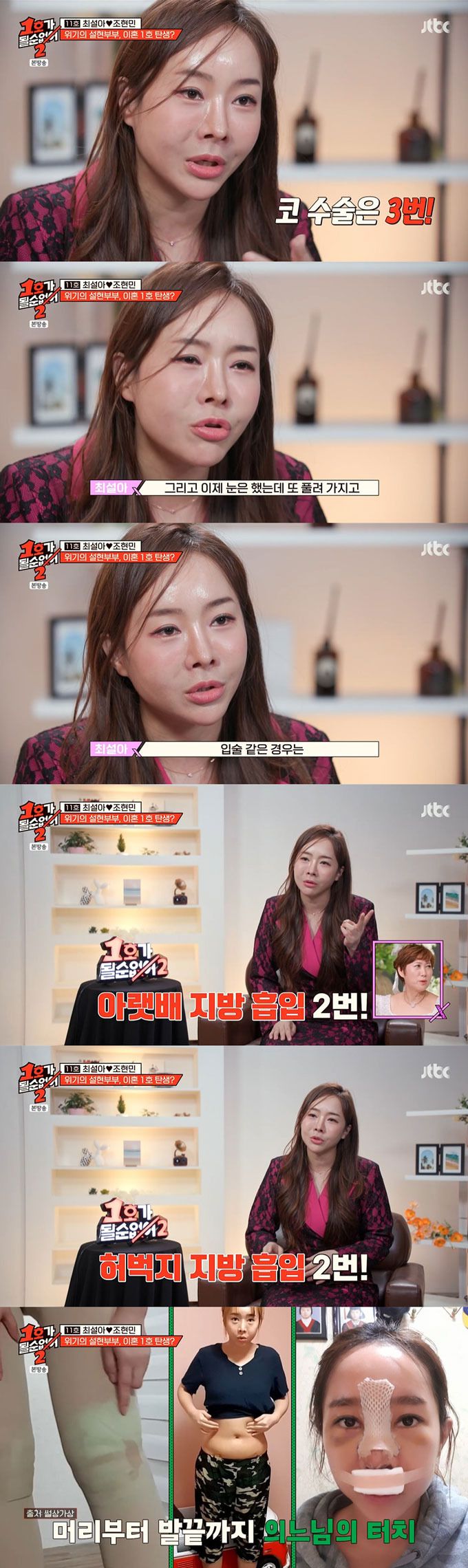 코미디언 최설아가 눈, 코, 입술, 지방흡입 등 수많은 성형수술을 받았다고 고백했다. /사진=JTBC '1호가 될 순 없어2' 방송 화면