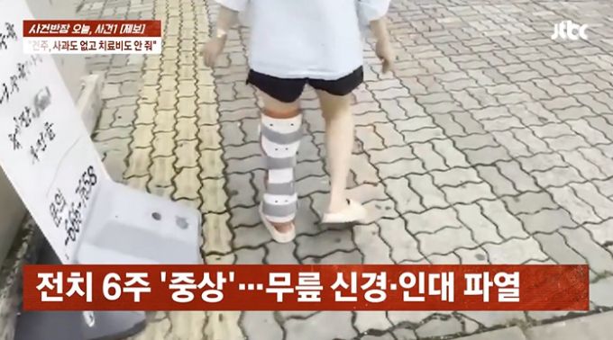 카센터에서 대형견에게 물린 피해자는 전치 6주 진단을 받았다. /사진=JTBC '사건반장' 방송 화면