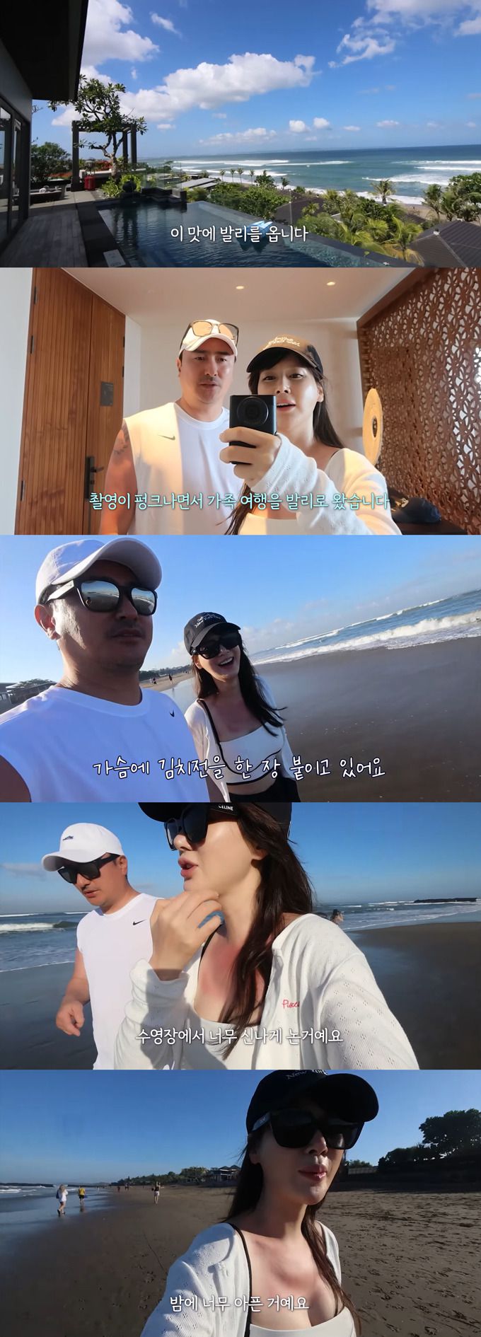 미스코리아 출신 방송인 이혜원이 여행 중 입은 화상 통증을 호소했다./사진=유튜브 채널 '제2혜원' 영상