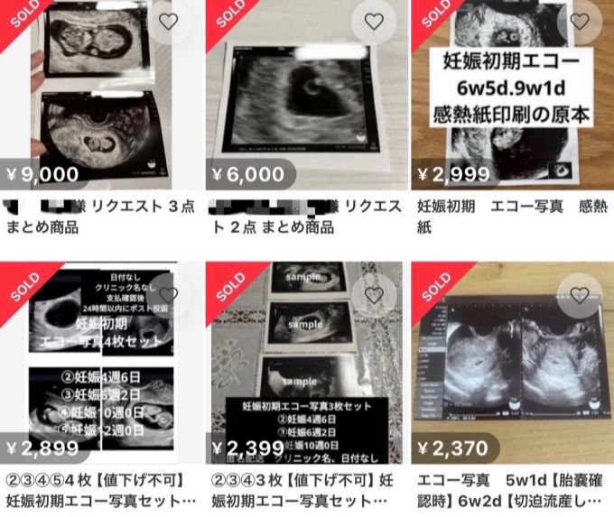 일본의 중고거래 플랫폼 메루카리에 게재된 태아 초음파 거래 자료사진./사진=온라인 SNS(소셜미디어) 화면캡쳐.