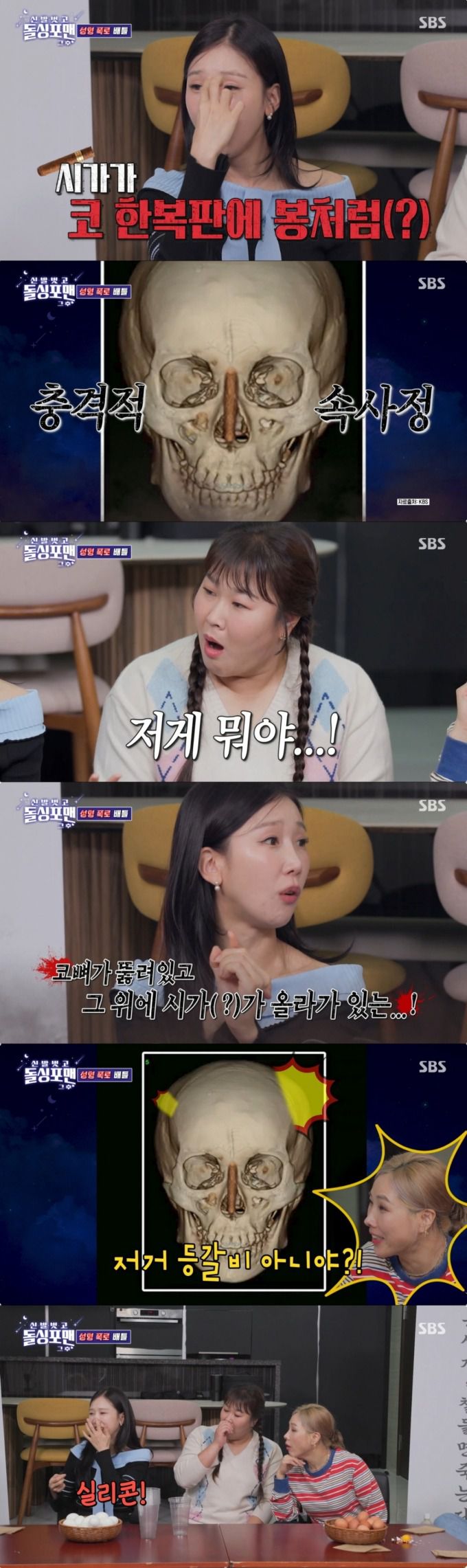 실리콘이 보이는 CT사진을 공개한 박소영. /사진=SBS '신발 벗고 돌싱포맨' 캡처