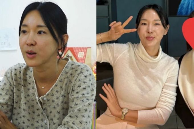 가수 겸 방송인 이지혜가 인중축소술을 받은지 한달 뒤의 달라진 얼굴을 공개했다. /사진=이지혜 유튜브 영상, 인스타그램 갈무리