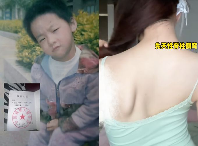 뇌성마비를 가진 뷰티 인플루언서 린링이 수천만원의 빚을 갚아 화제를 모았으나, 장애를 꾸며냈다는 의혹이 제기돼 논란이 일었다. 이에 린링은 장애인 증명서를 공개하며 반박했다. /사진=홍콩 사우스차이나모닝포스트(SCMP) 캡처, 더우인