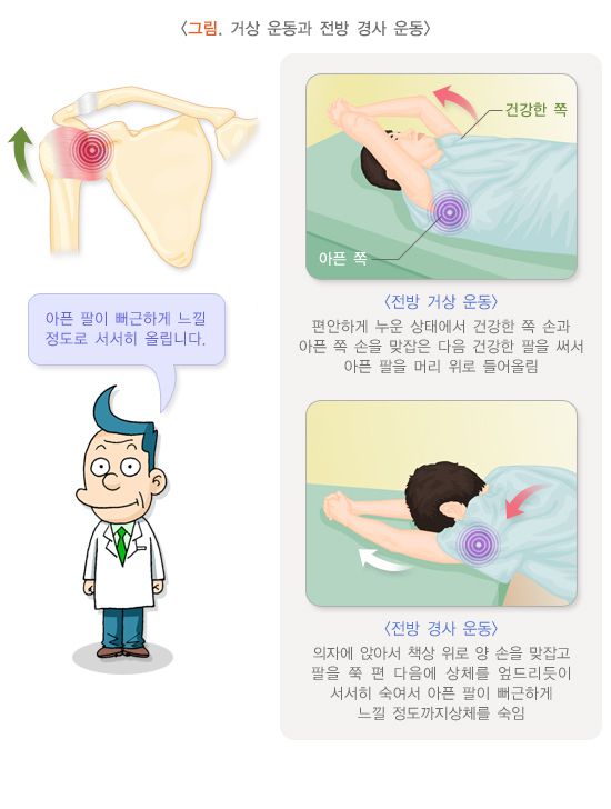 오십견 환자의 거상 운동(위)과 전방 경사 운동 설명 이미지. /사진제공=질병관리청