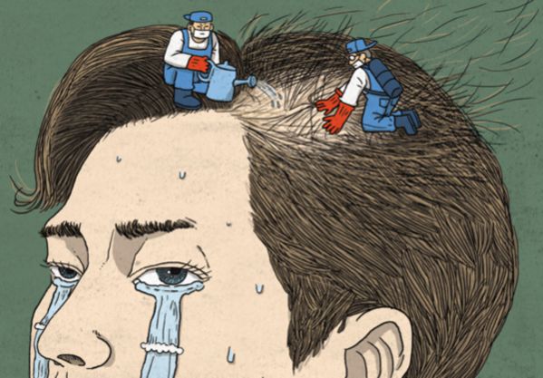 탈모 일러스트. /조선DB