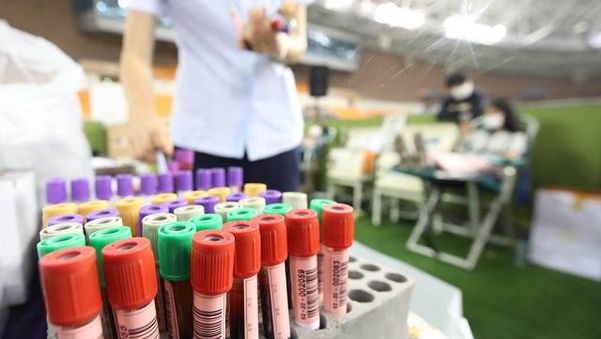 코로나19 혈장치료제를 만들기 위해 완치자에게 공여받은 혈장. /연합뉴스