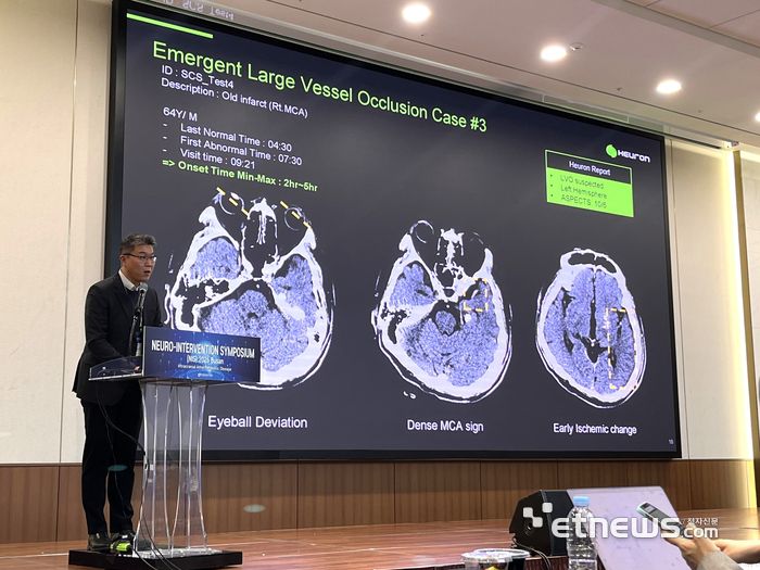 지난 8일 부산에서 열린 대한뇌혈관내치료의학회에서 박찬익 휴런 부사장이 휴런스트로케어스위트를 적용 사례 등을 발표했다.
