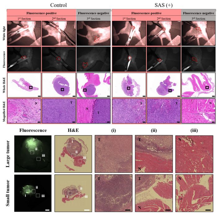 형광 가이드 수술에서의 조직 분석
