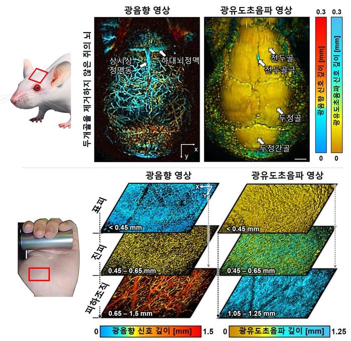생체 내 쥐 뇌 및 사람 손에서의 광음향/광유도초음파 동시 영상 결과