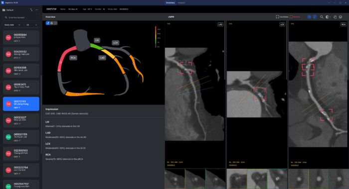 관상동맥 CT 분석 'Angiomics'