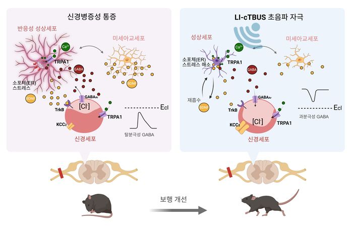 'LI-cTBUS'가 통증을 완화하는 작동 원리