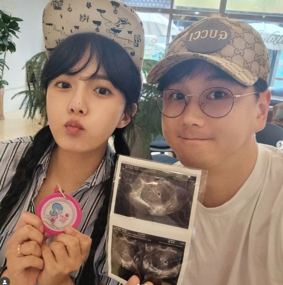 강은비와 변준필이 태아 초음파 사진을 들고 임신 소식을 알렸다. [사진=강은비 SNS]