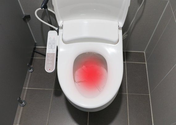 원숭이두창 증상에 기존의 발열이나 두통 뿐 아니라 항문 통증 증상이 보고됐다. /사진=뉴시스