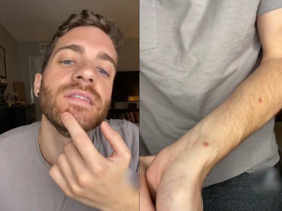 원숭이두창에 감염됐다고 밝힌 미국 영화배우 '맷 포드'. 사진=뉴스1