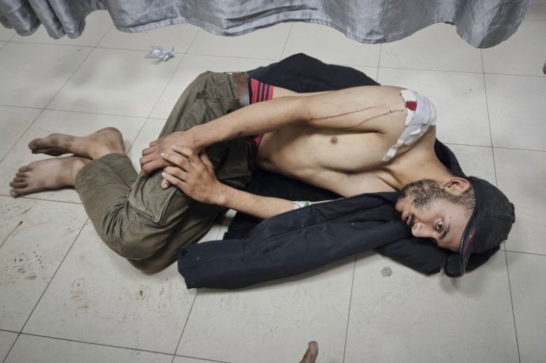 18일(현지 시간) 가자지구 남부 칸 유니스에서 이스라엘군 공습으로 부상 입은 남성이 치료를 기다리고 있다. 2025.03.18. /사진=뉴시스