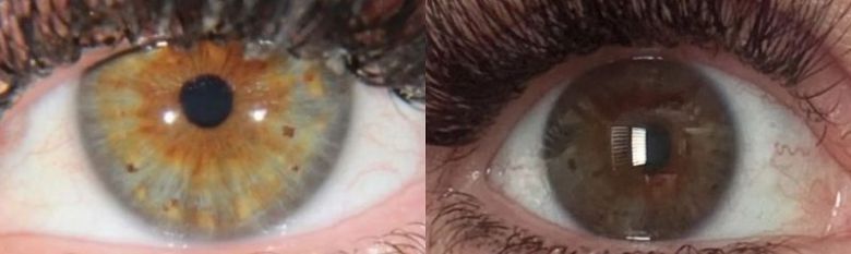 번개 맞은 뒤 눈동자 색깔이 변한 일렉트릭의 모습과 변한 후 모습. 출처=더 선