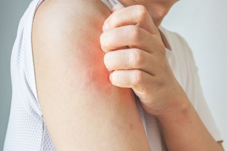 사진은 기사 본문과 무관함./사진=게티이미지뱅크