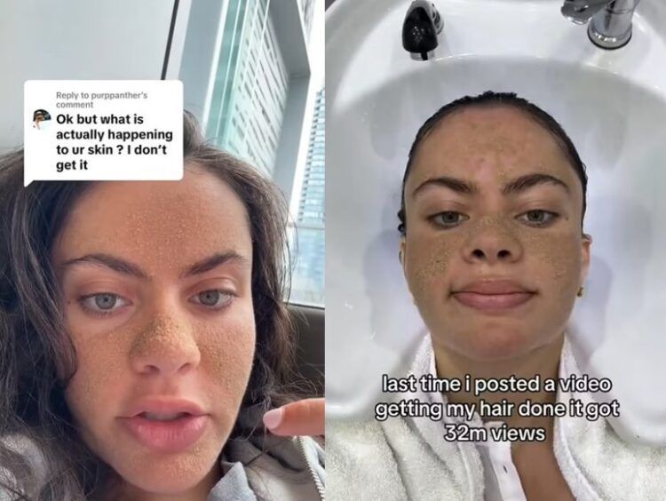 피부 본연의 회복력을 기대하며 세안을 포함한 모든 피부관리를 중단한 22세 여성의 실험이 SNS에서 화제가 되고 있다. [사진=SNS]