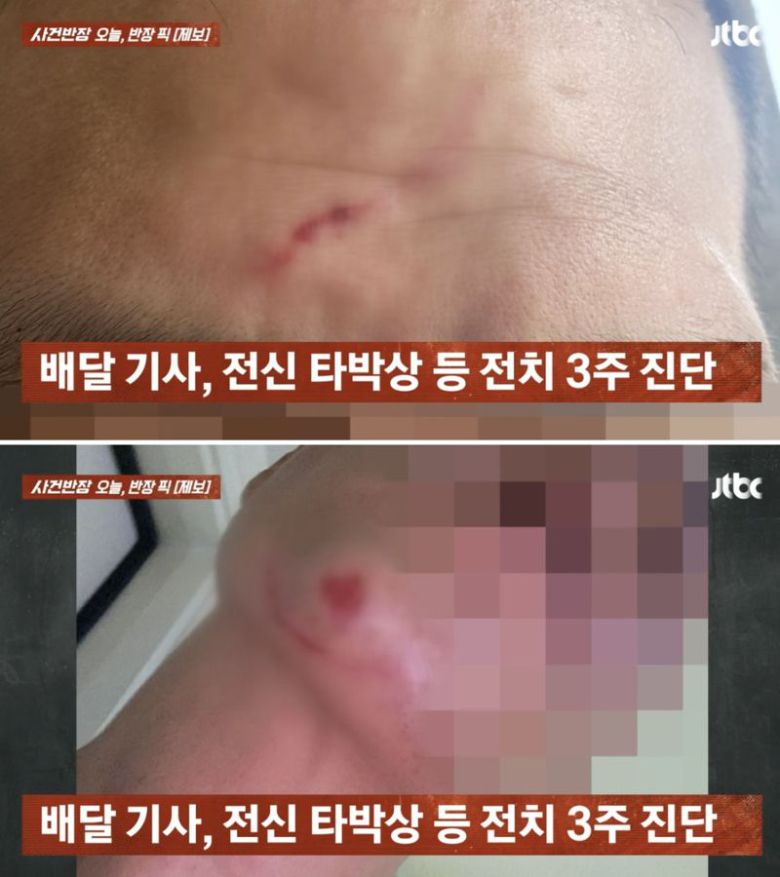 지난 24일 오전 7시50분께 충북 청주 시내 한 도로에서 배달 기사가 한 남성에게 폭행을 당했다./사진=JTBC '사건반장' 캡처