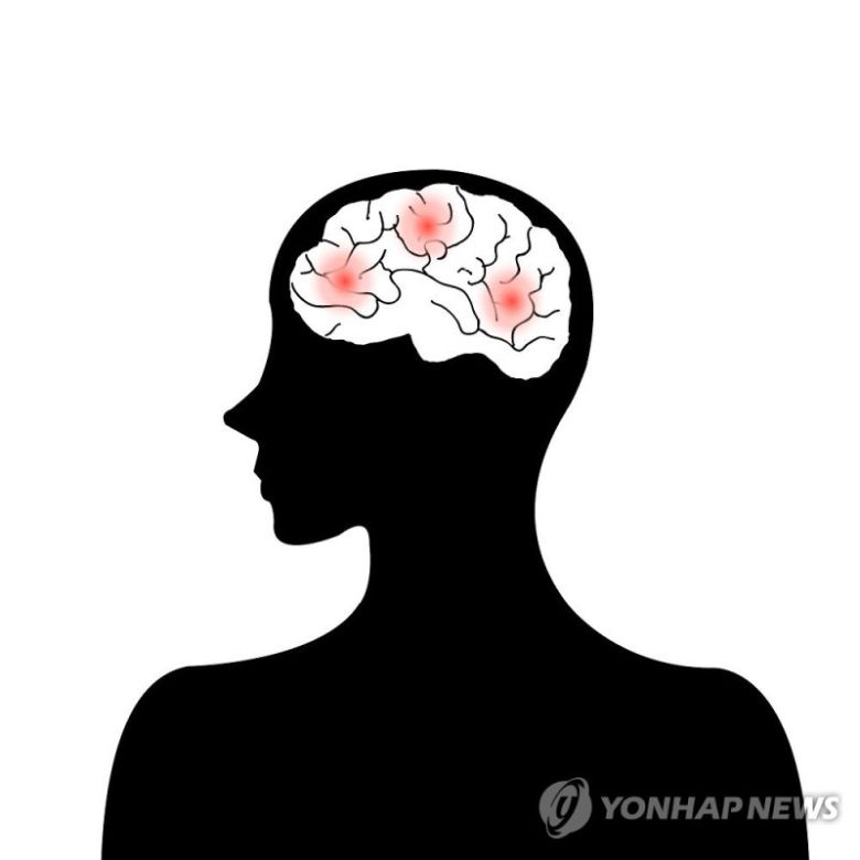 뇌졸중, 뇌출혈 (일러스트)