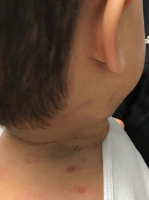 [서울=뉴시스] 미국 생후 15개월 남아가 누나의 머리카락에 목이 감겨 의식을 잃는 사고가 발생했다. 당시 아이의 모습. (사진 = 큐어어스 캡처) 2025.07.10. *재판매 및 DB 금지 /사진=뉴시스