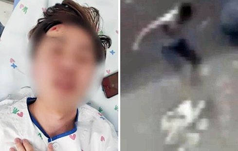 일면식도 없는 남성에게 무차별 폭행을 당한 고등학교 3학년 학생 /JTBC '사건반장' 갈무리