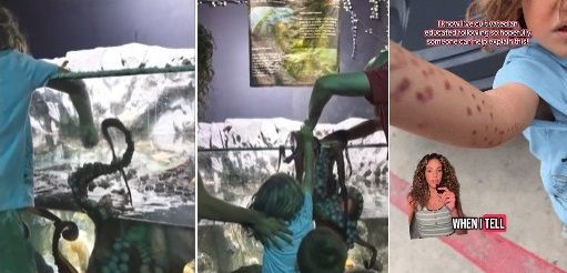 미국의 한 체험 수족관에서 대왕문어가 6세 소년의 팔을 붙잡고 상처를 남겼다. 영상=틱톡