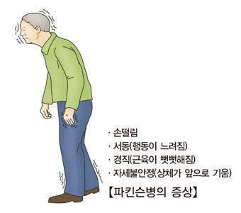 [출처: 서울아산병원]