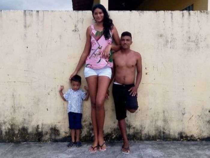 거인증으로 고통받은 엘리사네 다 크루즈 실바의 가족. 출처=틱톡