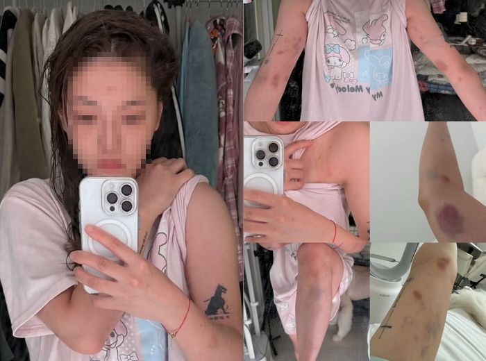 서울 도심에서 대만인 여성이 한국인 남성들한테 폭행당한 사건이 발생했다./사진=A씨 SNS 캡처