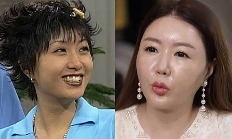 배우 이의정의 과거 모습(왼쪽)과 현재 모습./MBC 시트콤 ‘남자 셋 여자 셋’, MBN ‘명을 사수하는 사람들 명사수’