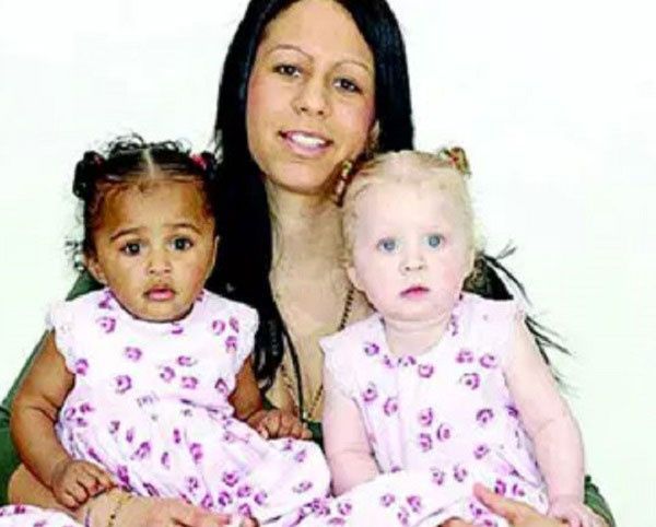 아버지가 서로 다른 쌍둥이가 태어난 사례가 최근 SNS에 올라와 화제다./사진=외신 매체 'vanguardngr' 캡처