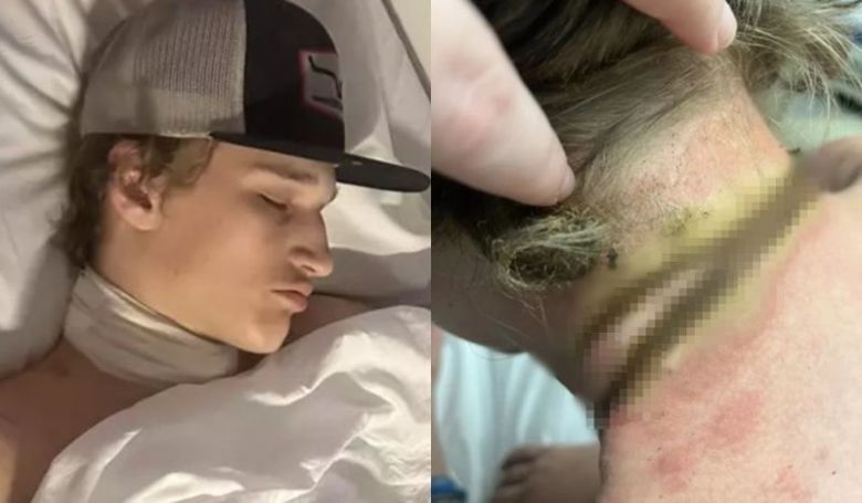 침대에서 휴대폰을 충전하던 중 감전 사고를 당해 중상을 입은 레이스 오그달(16). 출처=미러