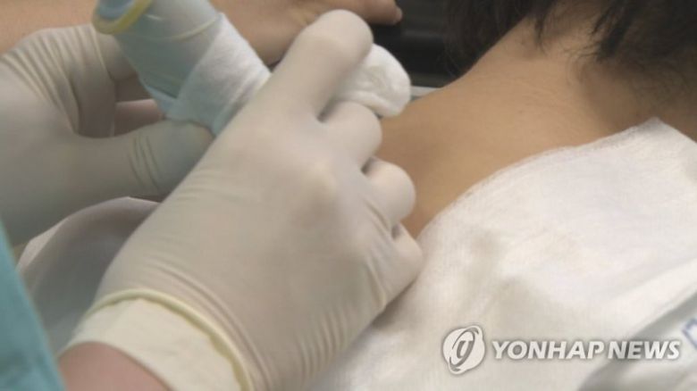 대상포진은 발병 후 72시간 내에 항바이러스를 투여하지 않으면 대상포진 후 신경통(PHN)이 남을 위험이 높아진다. 대상포진 후 신경통은 바이러스가 사라졌음에도 신경 손상이 남아 통증이 지속되는 현상이다. 고령일수록 대상포진 후 신경통을 앓을 가능성이 높아지므로, 50세 이상 성인에게 대상포진 예방접종이 권고된다. /연합뉴스