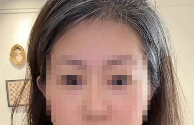 극심한 충격과 스트레스로 단 하루 만에 백발이 되어버린 중국 여성. 사진=바이두