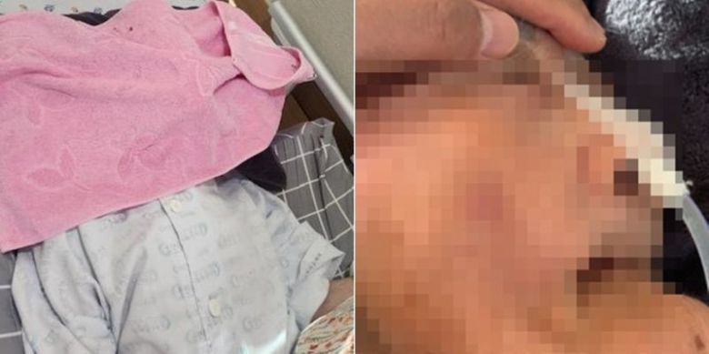 요양병원에 입원 중인 어머니의 얼굴에 누군가가 수건을 놓아 숨을 쉬지 못하는 장면을 봤다는 보호자의 사연이 알려졌다. 온라인커뮤니티 '보배드림' 갈무리